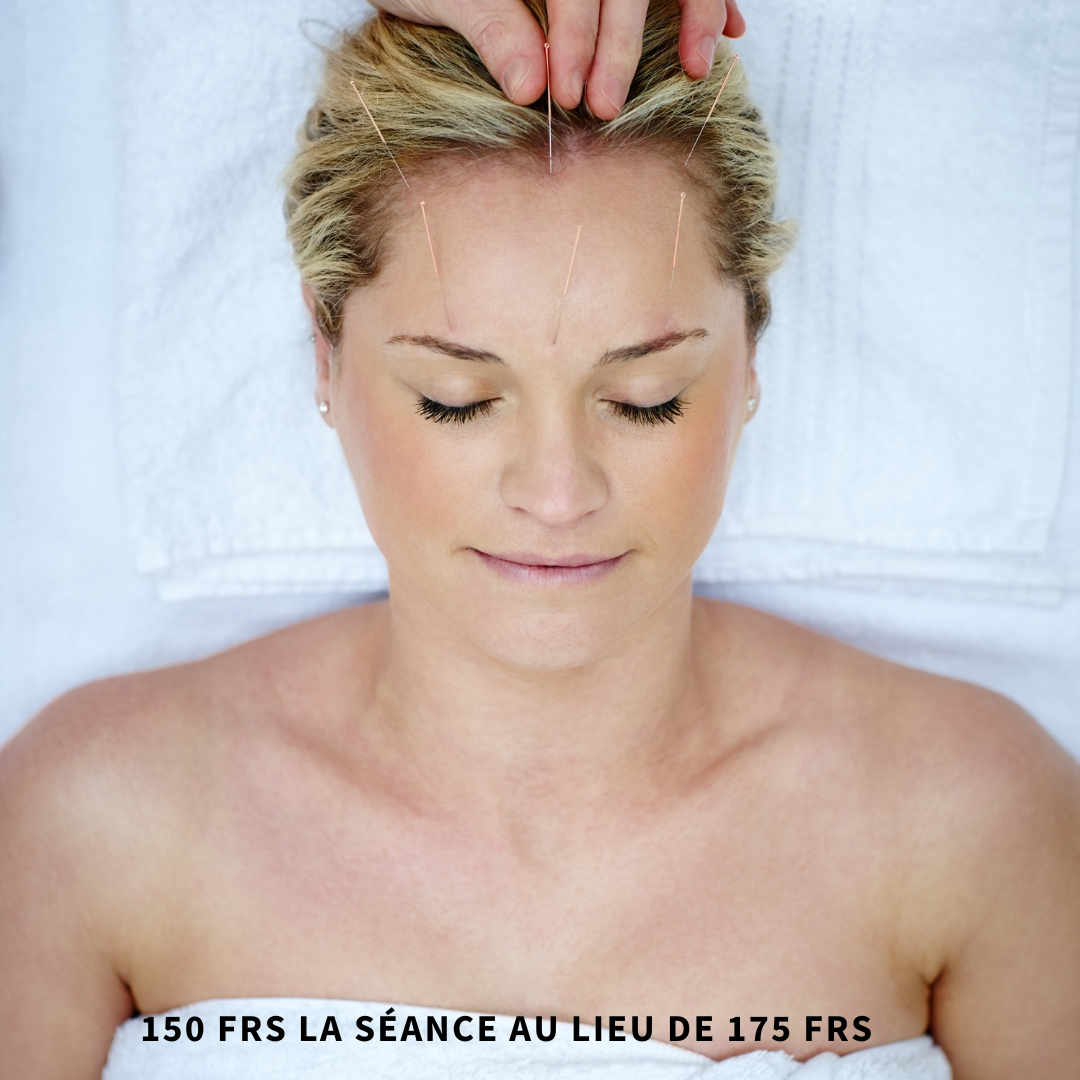 aculifting valais